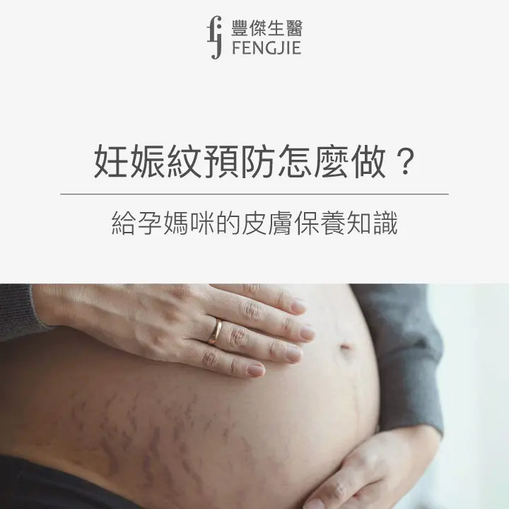 妊娠紋預防怎麼做？