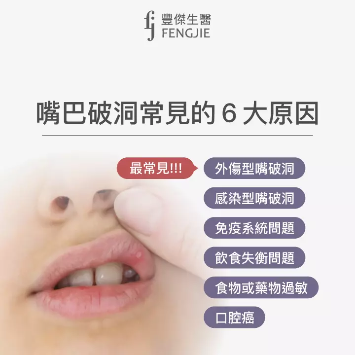 嘴巴破洞常見的6大原因：外傷型、感染型、免疫系統問題、飲食失衡、食物或藥物過敏、口腔癌