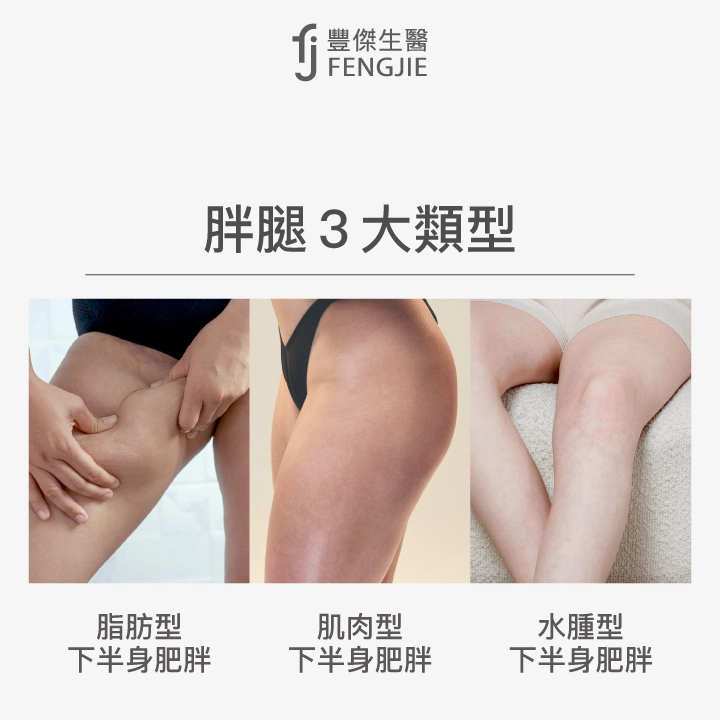 胖腿3大類型：脂肪型下半身肥胖、肌肉型下半身肥胖、水腫型下半身肥胖