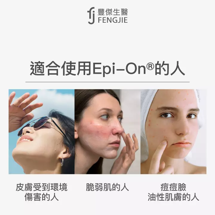 適合使用Epi-On®的人：皮膚受到環境傷害的人、修修臉的人、痘痘臉、油性肌膚的人