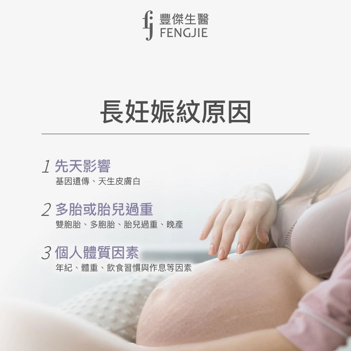 長妊娠紋原因：先天基因影響、多胞胎或胎兒過重、個人體質因素