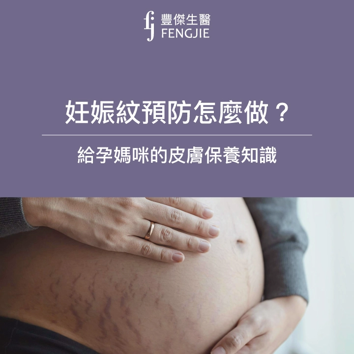 妊娠紋預防5大招：孕期皮膚保養、妊娠紋消除法大公開！