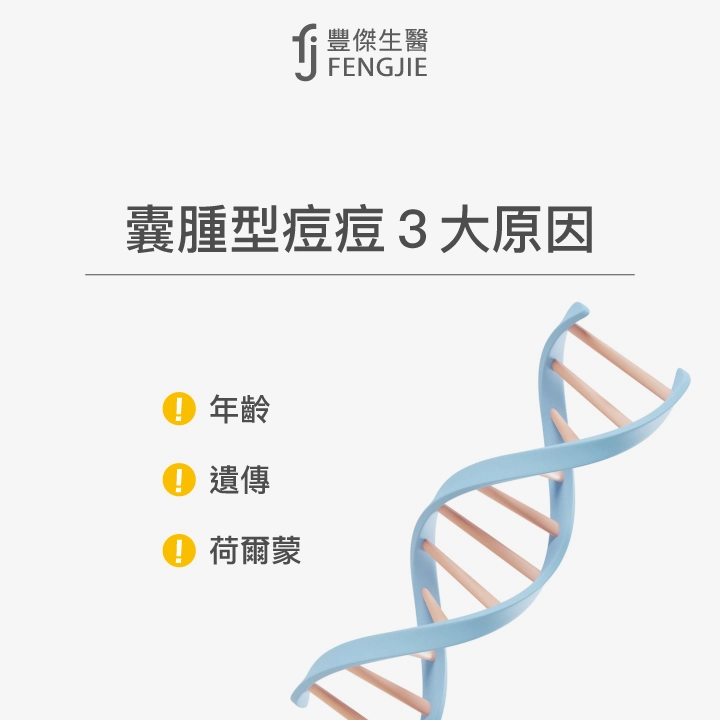 囊腫型痘痘3大原因：年齡、遺傳、荷爾蒙