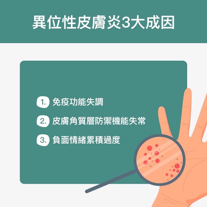 異位性皮膚炎3大成因：免疫功能失調、皮膚角質層防禦機能失常、負面情緒累積過度