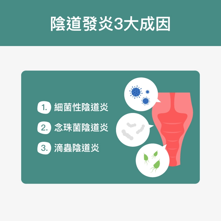 陰道發炎3大成因：細菌性陰道炎、念珠菌陰道炎、滴蟲陰道炎