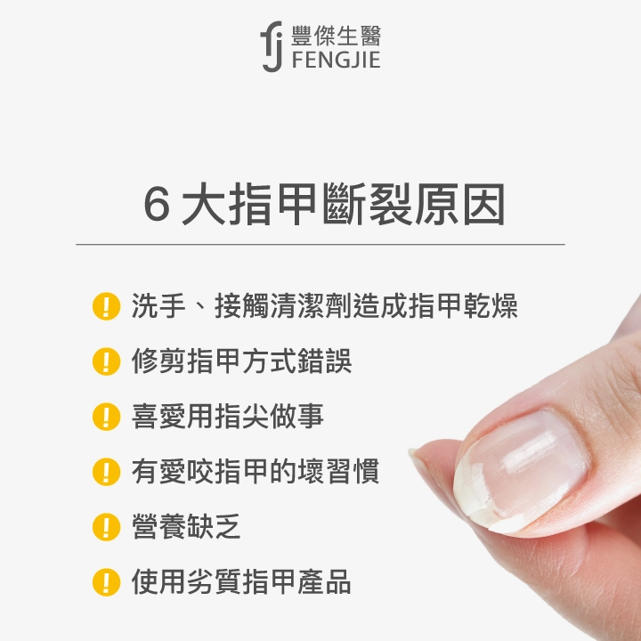 6大指甲斷裂原因：洗手、接觸清潔劑造成指甲乾燥、修剪指甲方式錯誤、喜愛用指尖做事、有愛咬指甲的壞習慣、營養缺乏、使用劣質指甲產品