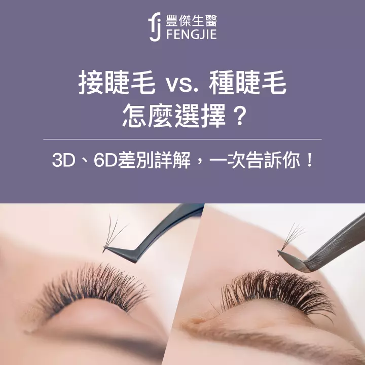 接睫毛 vs. 種睫毛：怎麼選擇？3D、6D差別詳解，一次告訴你！
